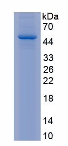 Recombinant Interleukin 6 (IL6)