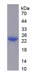 Recombinant Interleukin 6 (IL6)