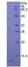 Recombinant Interleukin 8 (IL8)