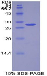 RPA083Hu01.jpg