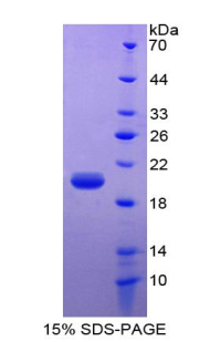 Recombinant Leptin (LEP)