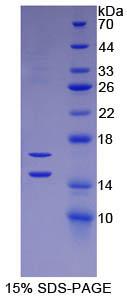 RPA087Hu01.jpg