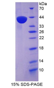 RPA092Hu01.jpg