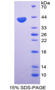 RPA093Hu01.jpg