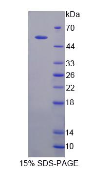 Recombinant Matrix Metalloproteinase 1 (MMP1)