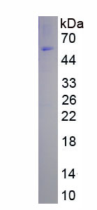 Recombinant Matrix Metalloproteinase 1 (MMP1)