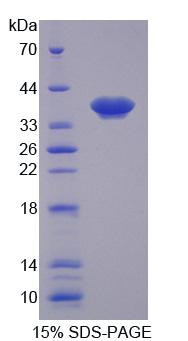 Recombinant Matrix Metalloproteinase 1 (MMP1)