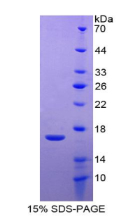 RPA101Hu03.jpg