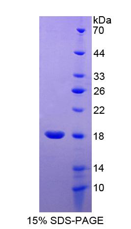 RPA107Hu01.jpg