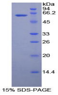 RPA113Hu01.jpg