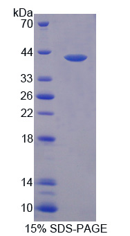 RPA115Hu01.jpg