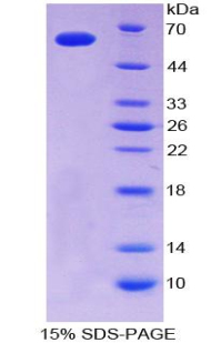 RPA119Hu03.jpg