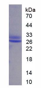 Recombinant Stem Cell Factor (SCF)