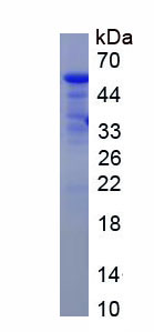 Recombinant TEK Tyrosine Kinase, Endothelial (Tie2)