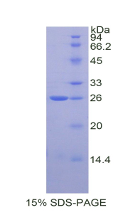 Recombinant Tissue Inhibitors Of Metalloproteinase 3 (TIMP3)