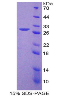 Recombinant Thrombopoietin (TPO)