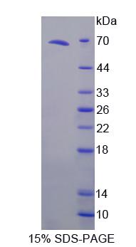 Recombinant Tumor Necrosis Factor Receptor Superfamily, Member 10C (TNFRSF10C)