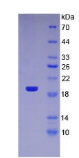 Recombinant Tumor Necrosis Factor Related Apoptosis Inducing Ligand (TRAIL)