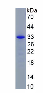 Recombinant Tumor Necrosis Factor Related Apoptosis Inducing Ligand (TRAIL)