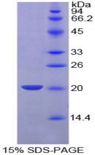 Recombinant Plasminogen Activator, Urokinase (uPA)