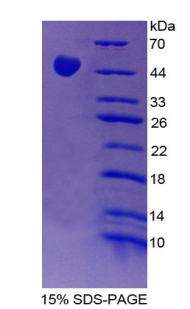 Recombinant Plasminogen Activator, Urokinase (uPA)