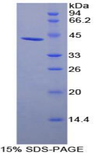 RPA141Hu03.jpg