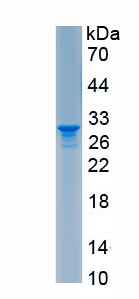 Recombinant Carcinoembryonic Antigen (CEA)