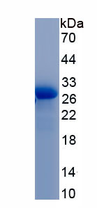 Recombinant Prostate Specific Antigen (PSA)