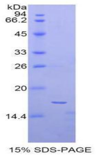 Recombinant Alpha-Fetoprotein (AFP)