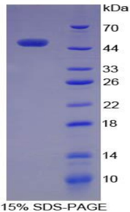 Recombinant Alpha-Fetoprotein (AFP)