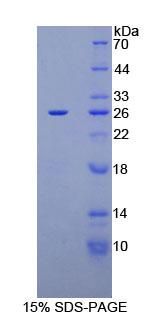 RPA154Hu01.jpg