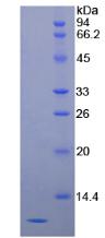 Recombinant Serpin Peptidase Inhibitor,Clade B,Member 4 (SERPINB4)