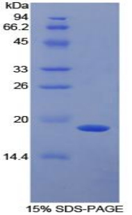 Recombinant Alpha 2-Antiplasmin (a2PI)