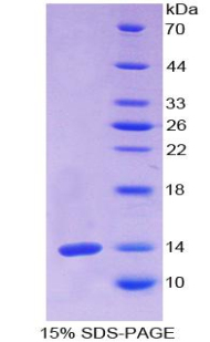 RPA162Hu01.jpg