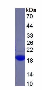 Recombinant Glucosidase Alpha, Acid (GaA)