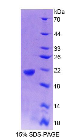 Recombinant Glucosidase Alpha, Acid (GaA)