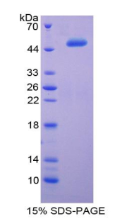 RPA179Hu02.jpg