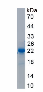 RPA181Hu02.jpg