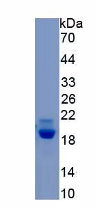 Recombinant Fatty Acid Binding Protein 9, Testis (FABP9)