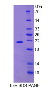 RPA204Hu02.jpg