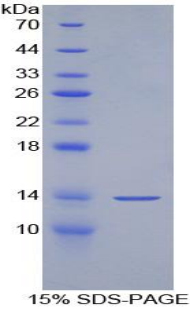 Recombinant Alanine Aminotransferase (ALT)