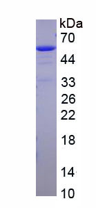 Recombinant Alanine Aminotransferase (ALT)