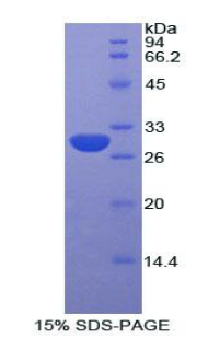 Recombinant Alanine Aminotransferase (ALT)