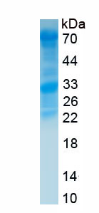 Recombinant Collagen Type I Alpha 2 (COL1a2)