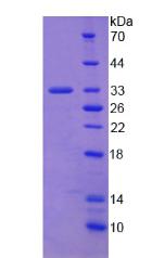 RPA215Hu01.jpg