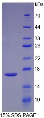 RPA218Hu01.jpg