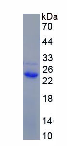 Recombinant Interferon Beta (IFNb)