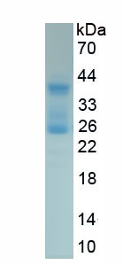 Recombinant Interferon Beta (IFNb)