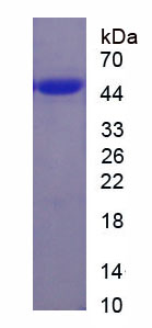 Recombinant Interferon Beta (IFNb)