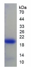 Recombinant Interleukin 1 Receptor Antagonist (IL1RA)